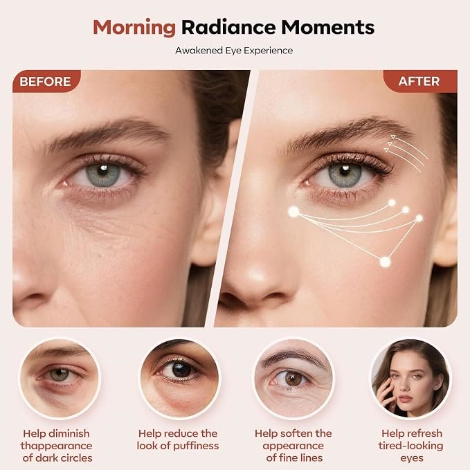 Before After Dark Circles Puffiness Fine Lines