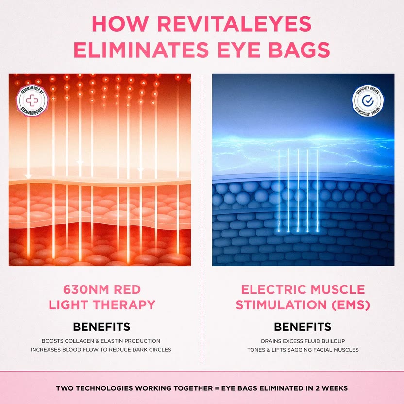 5-in-1 Smart Eye Massager Glasses - Red Light Therapy with Microcurrent  Heat & Vibration - image 6
