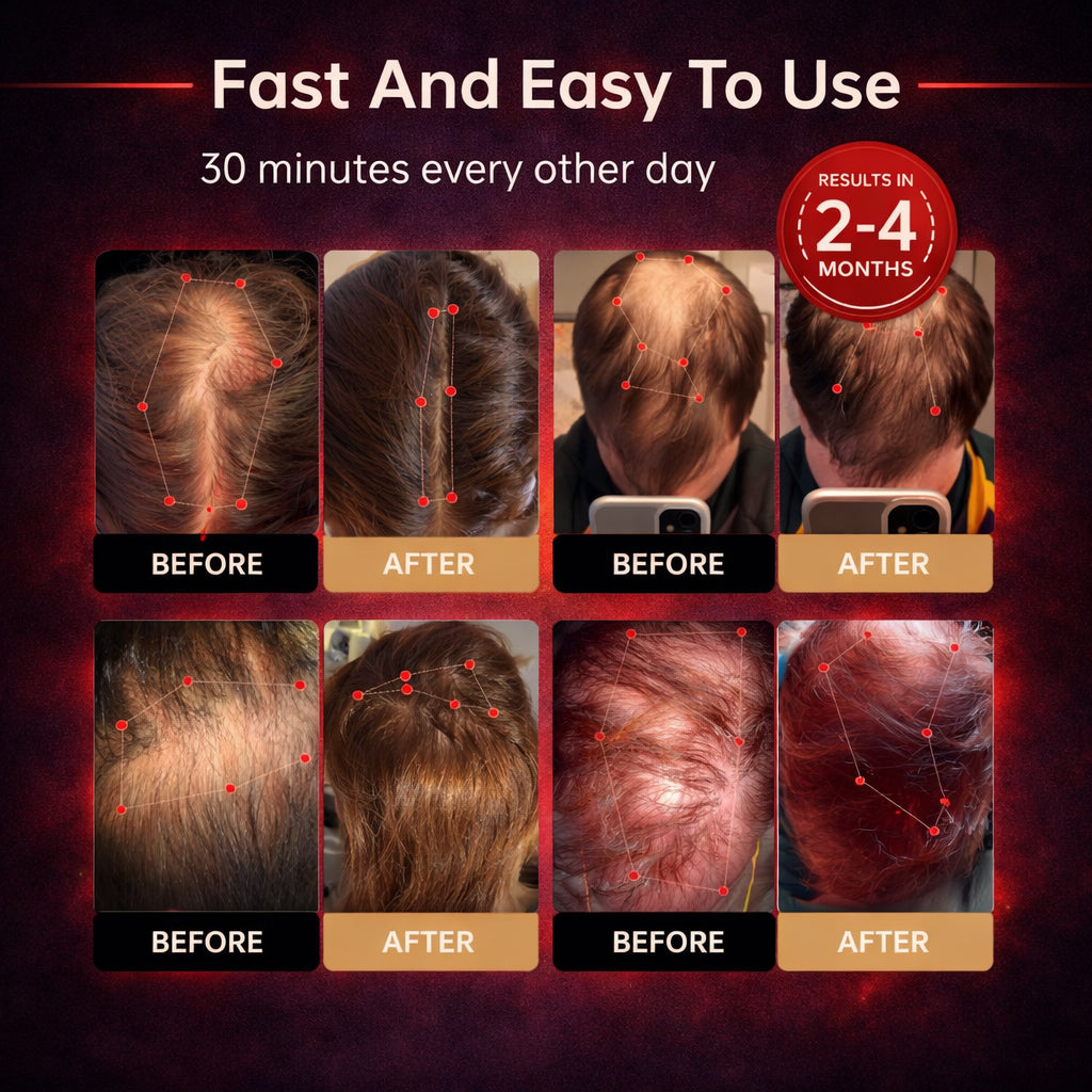 🔥Last Day- SAVE 80% OFF! Scienluma® Red Light Cap — Regrow Hair, Reduce Shedding & Bring Back What You Thought Was Gone