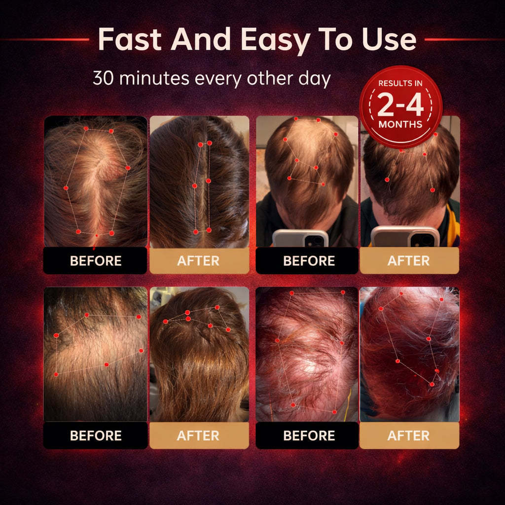 🔥Last Day- SAVE 80% OFF! Scienluma® Red Light Cap — Regrow Hair, Reduce Shedding & Bring Back What You Thought Was Gone