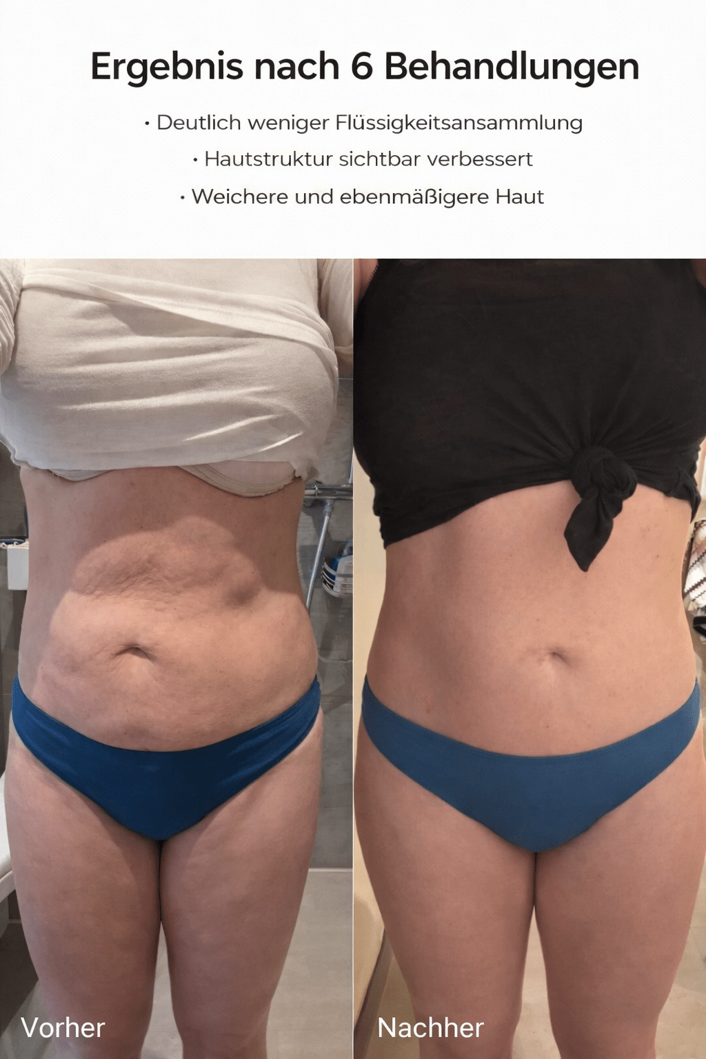 Celluviaa – smooth skin in 14 days