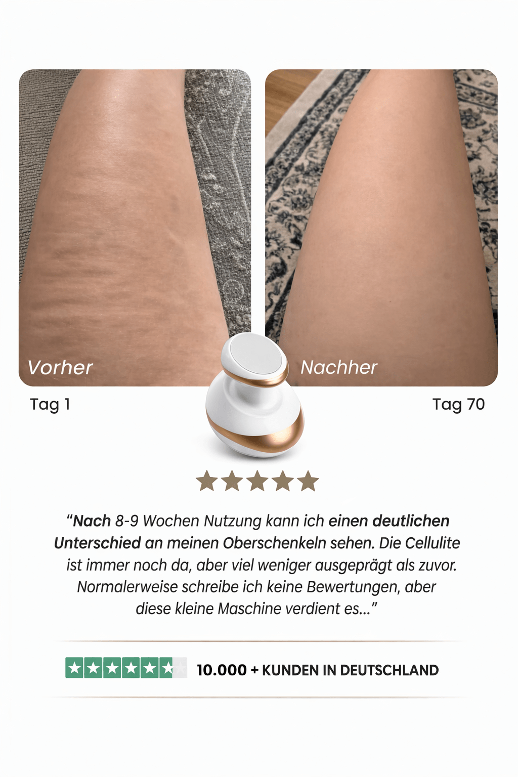 Celluviaa – smooth skin in 14 days