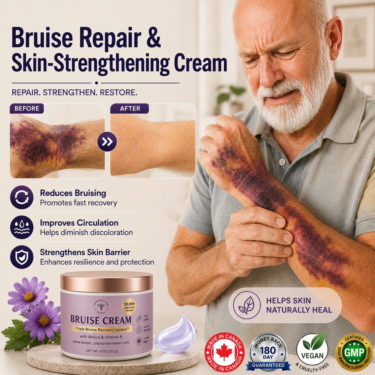 💥Over 100,000 units sold💕 - Bruise Cream to repair bruises and strengthen the skin