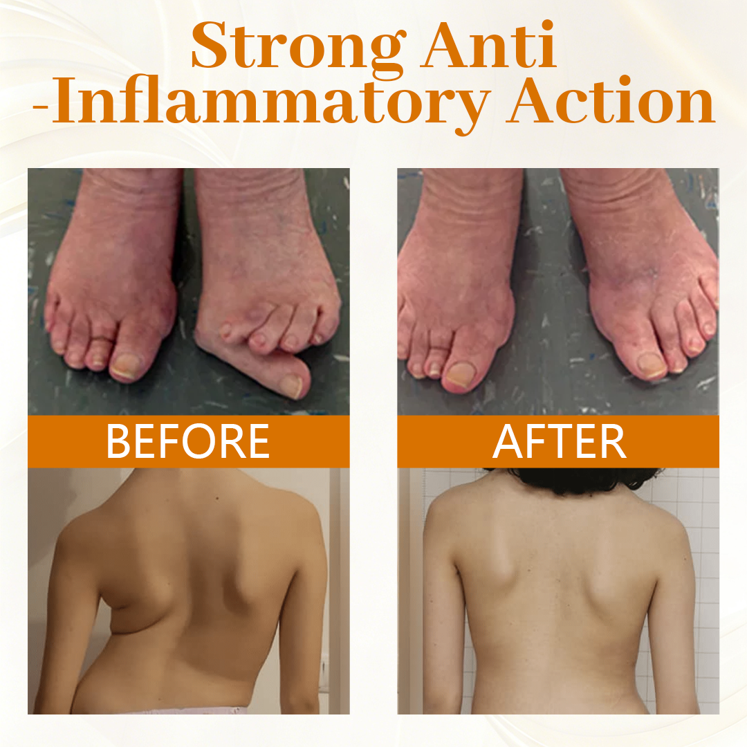 ScorpiTakt Joint & Muscle Relief Ointment