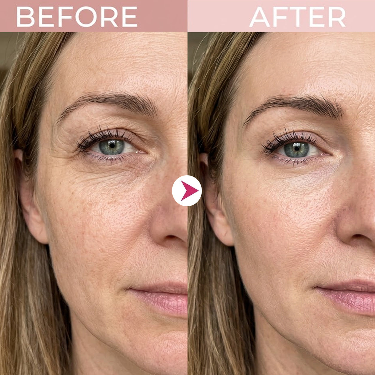 🔥 50% OFF — P7 Eye Renewal Crème for a Smoother, More Hydrated-Looking Eye Area ✨