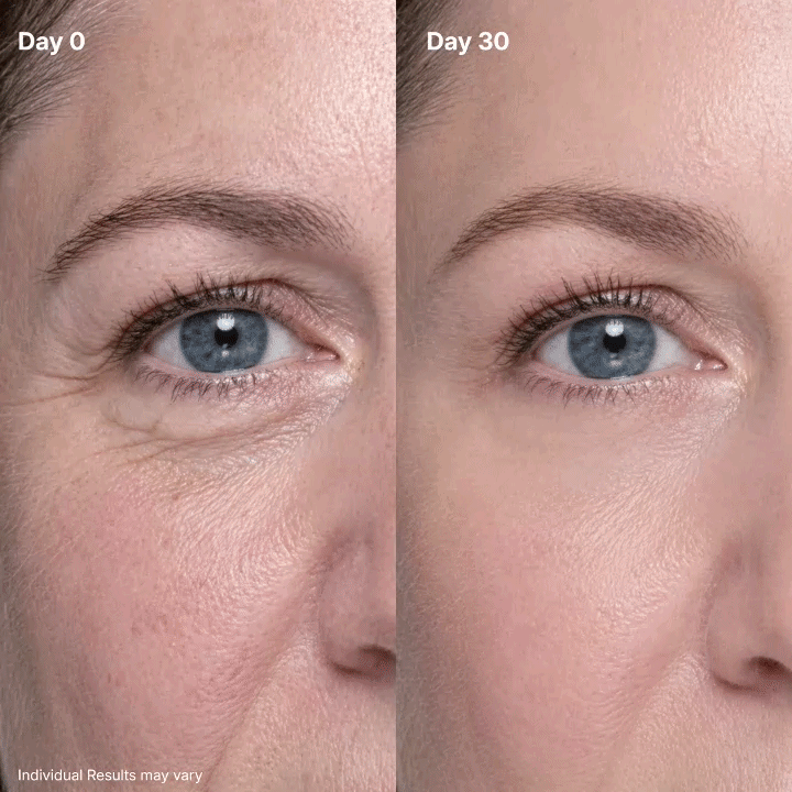 🔥 50% OFF — P7 Eye Renewal Crème for a Smoother, More Hydrated-Looking Eye Area ✨