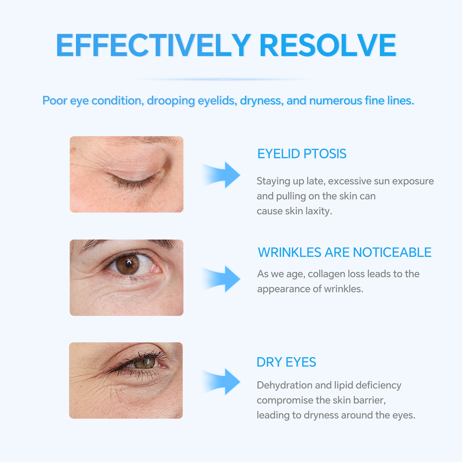 LUMAZO Herbal Anti-Aging Eye Cream, Firming & Hydrating Eye Cream for Wrinkles & Fine Lines, 50g