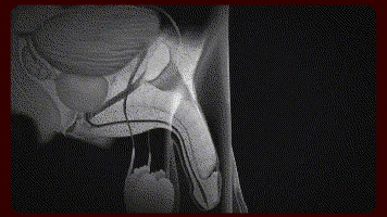 详情_14.gif