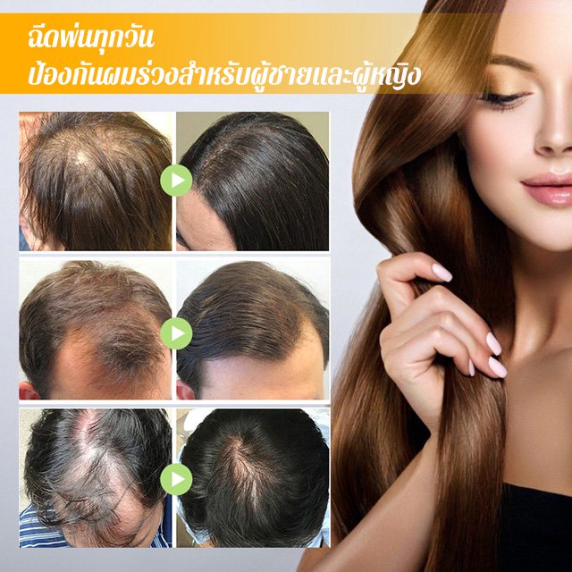(Versi terlaris) Semprotan anti rambut rontok, pertumbuhan rambut, biotin, memperkuat rambut, memperbaiki akar rambut.