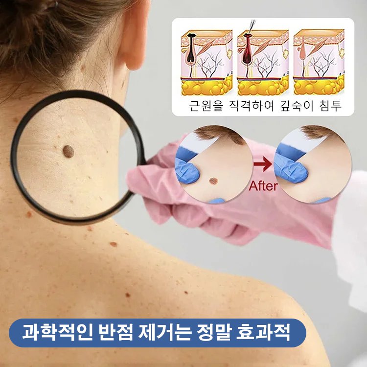 SLEELHOE Skin Care Patch Penghilang Kutil