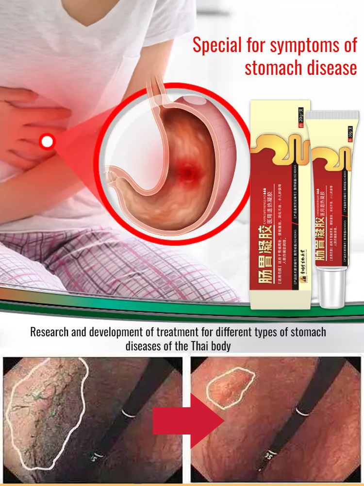 Gel pencernaan, bio-gel untuk sakit perut, kembung, dan sembelit.