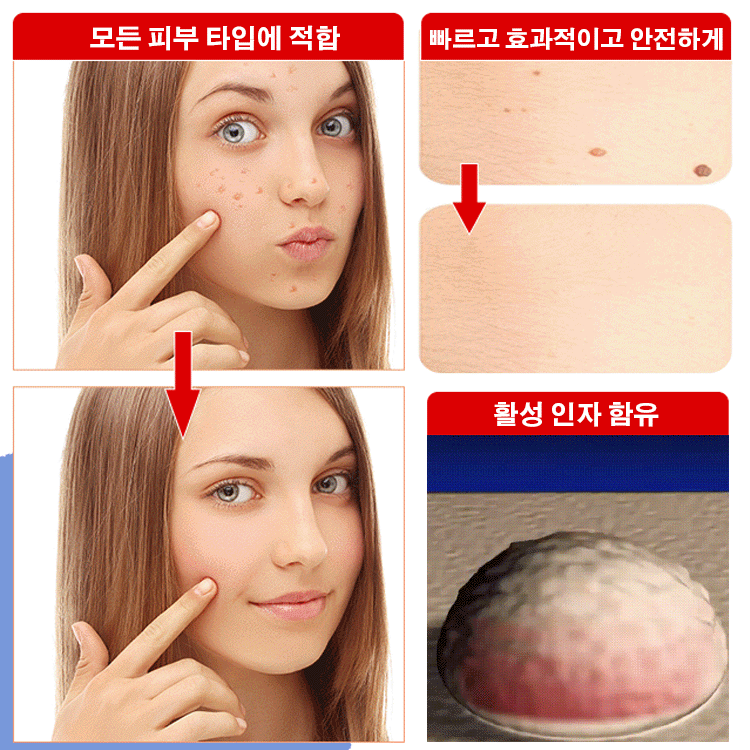 SLEELHOE Skin Care Patch Penghilang Kutil