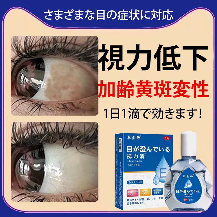 Obat tetes mata lembut yang diformulasikan dengan agen antibakteri.