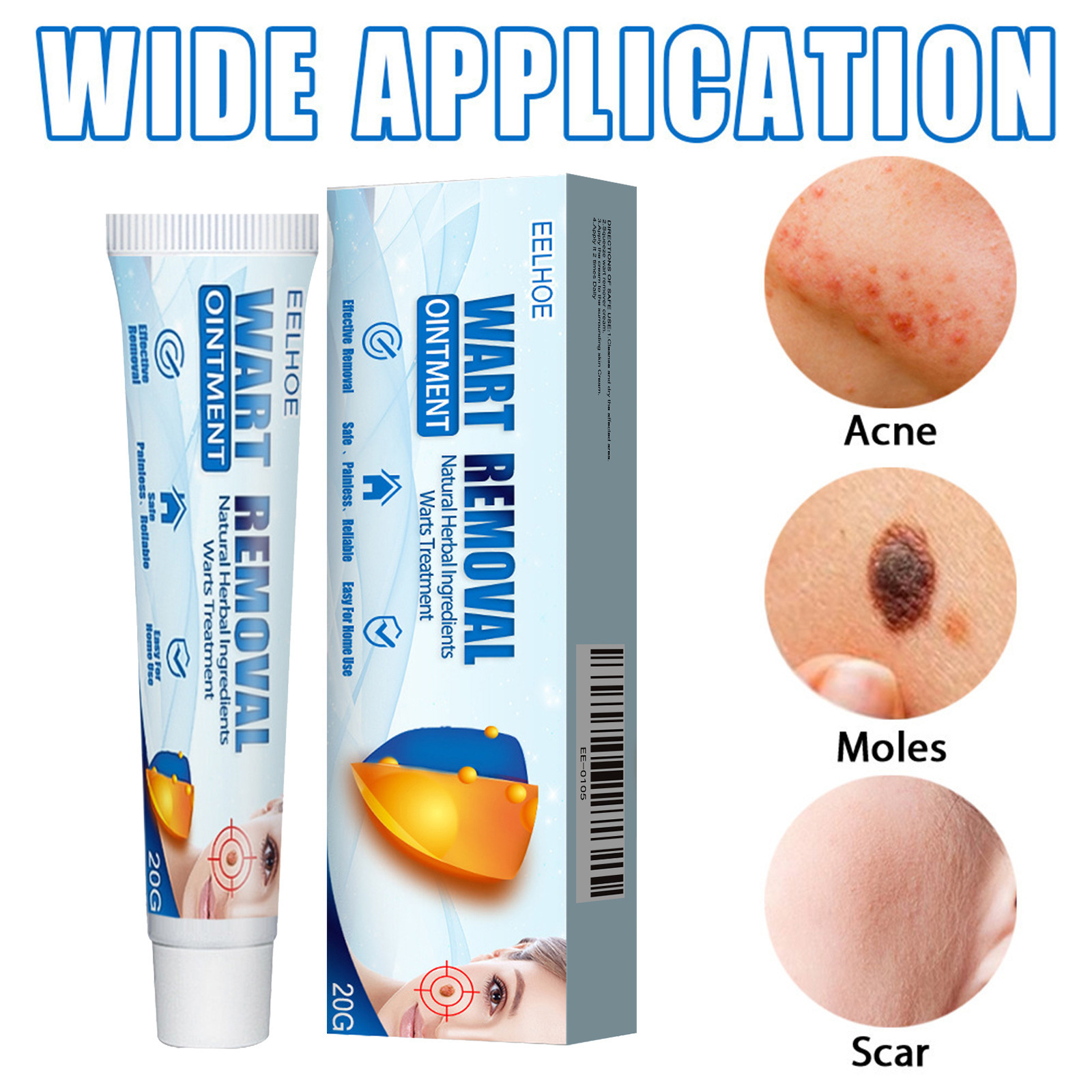 Krim perawatan kulit untuk kutil