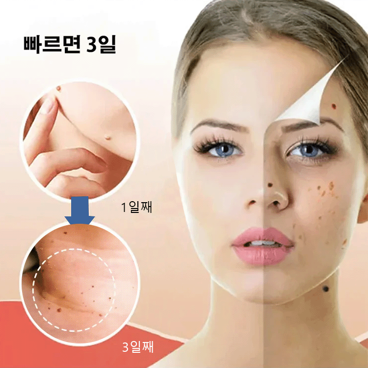 SLEELHOE Skin Care Patch Penghilang Kutil