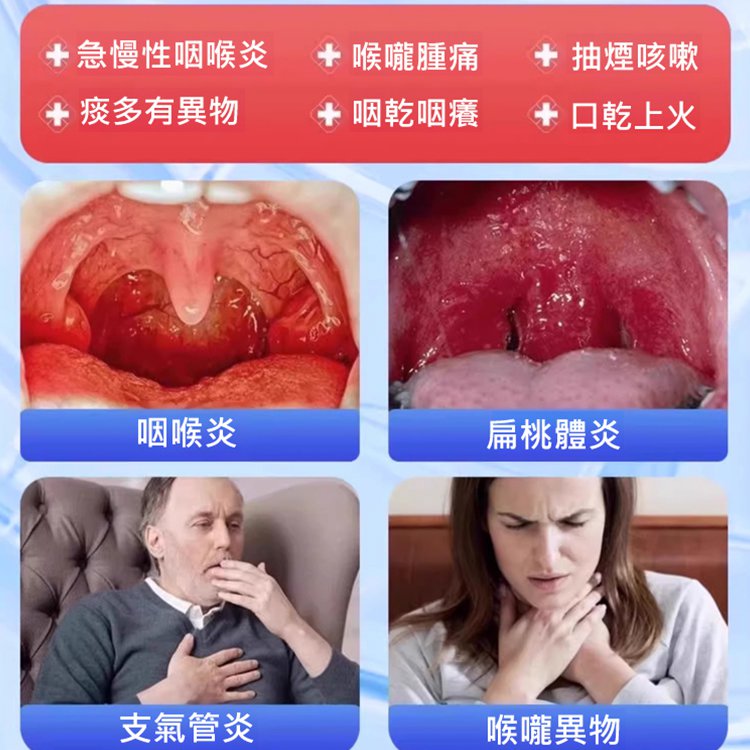 [Mencegah Faringitis Berulang] Gel Faring Li Shizhen