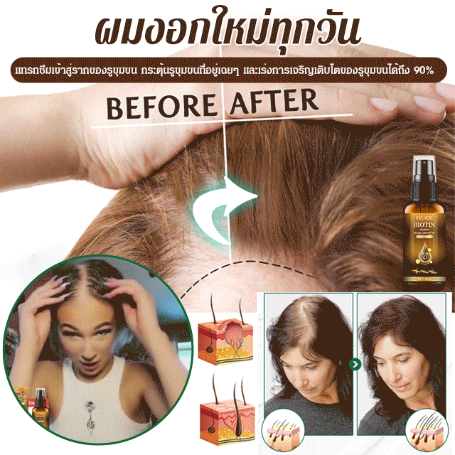 (Versi terlaris) Semprotan anti rambut rontok, pertumbuhan rambut, biotin, memperkuat rambut, memperbaiki akar rambut.