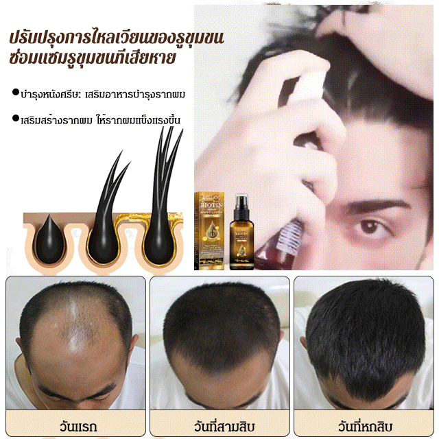 (Versi terlaris) Semprotan anti rambut rontok, pertumbuhan rambut, biotin, memperkuat rambut, memperbaiki akar rambut.