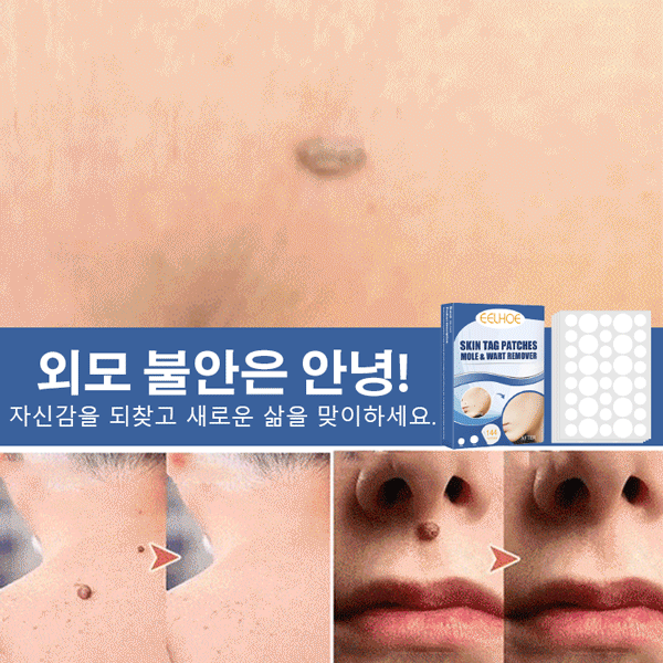 SLEELHOE Skin Care Patch Penghilang Kutil