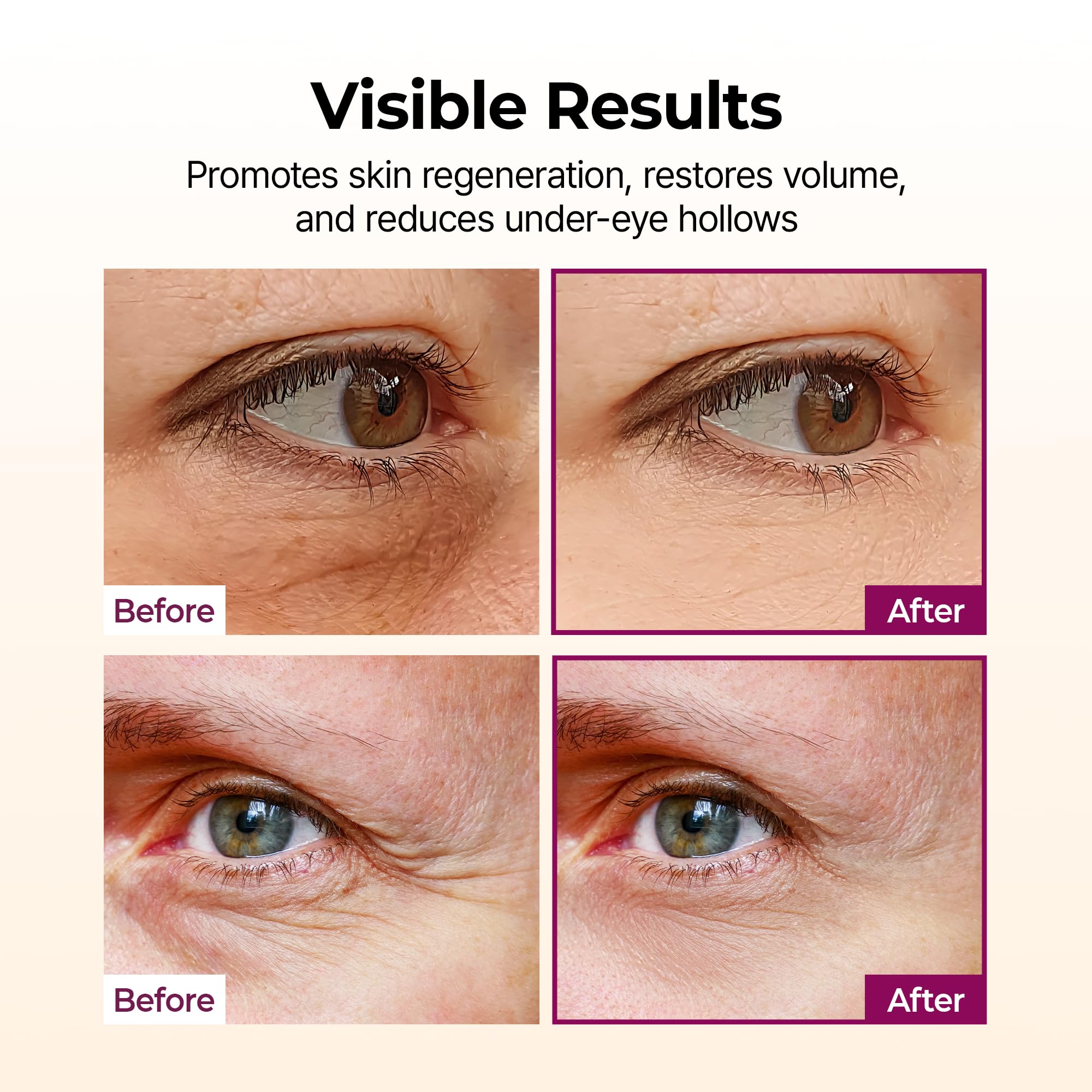 Collagen Multi Balm Stick &ndash; Firming Anti-Wrinkle Moisturizing Stick for Eyes, Face & Neck