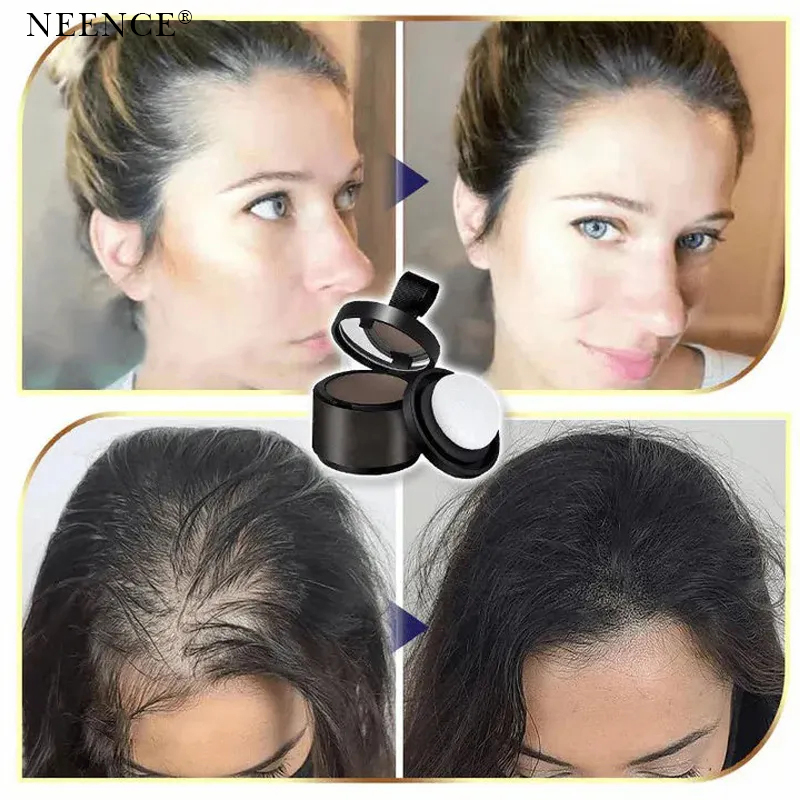 🔥2025 Hot Sale🔥 NEENCE® Premium Hairline Coverage Touch Up Powder