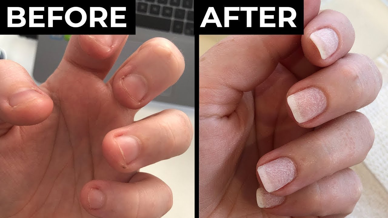 (💖Mother's Day Sale-BUY 2 GET 2 FREE)💅 Cuticle-Oil