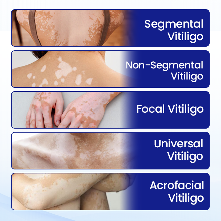 Oveallgo® Evenora Herbal Spray