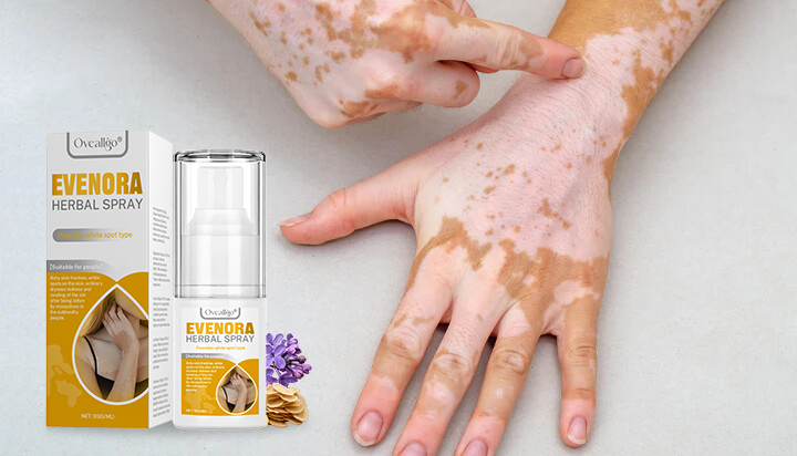 Oveallgo® Evenora Herbal Spray