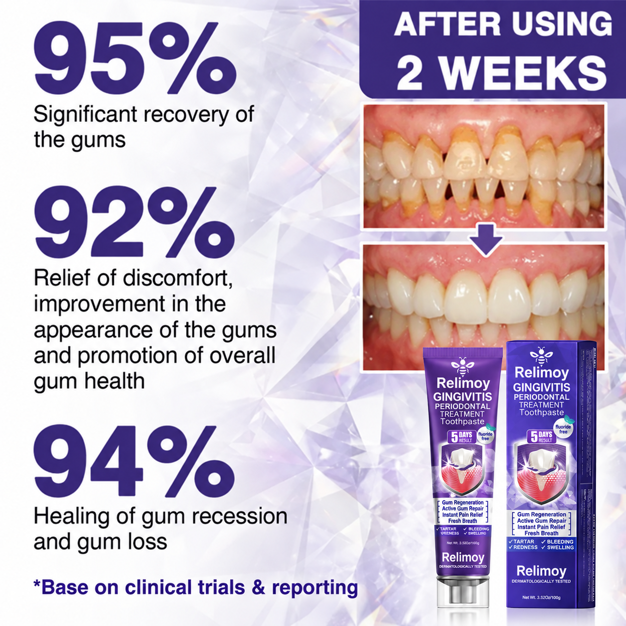 Relimoy® VioCore Bee Venom Gingivitis & Periodontitis Treatment Toothpaste