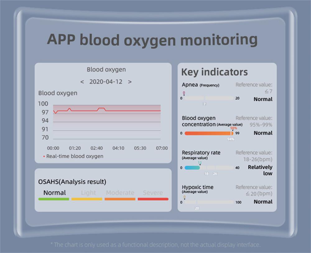 EP08 High-end ECG/EKG Blood Sugar Blood Oxygen Monitoring Waterproof Smart Bracelet