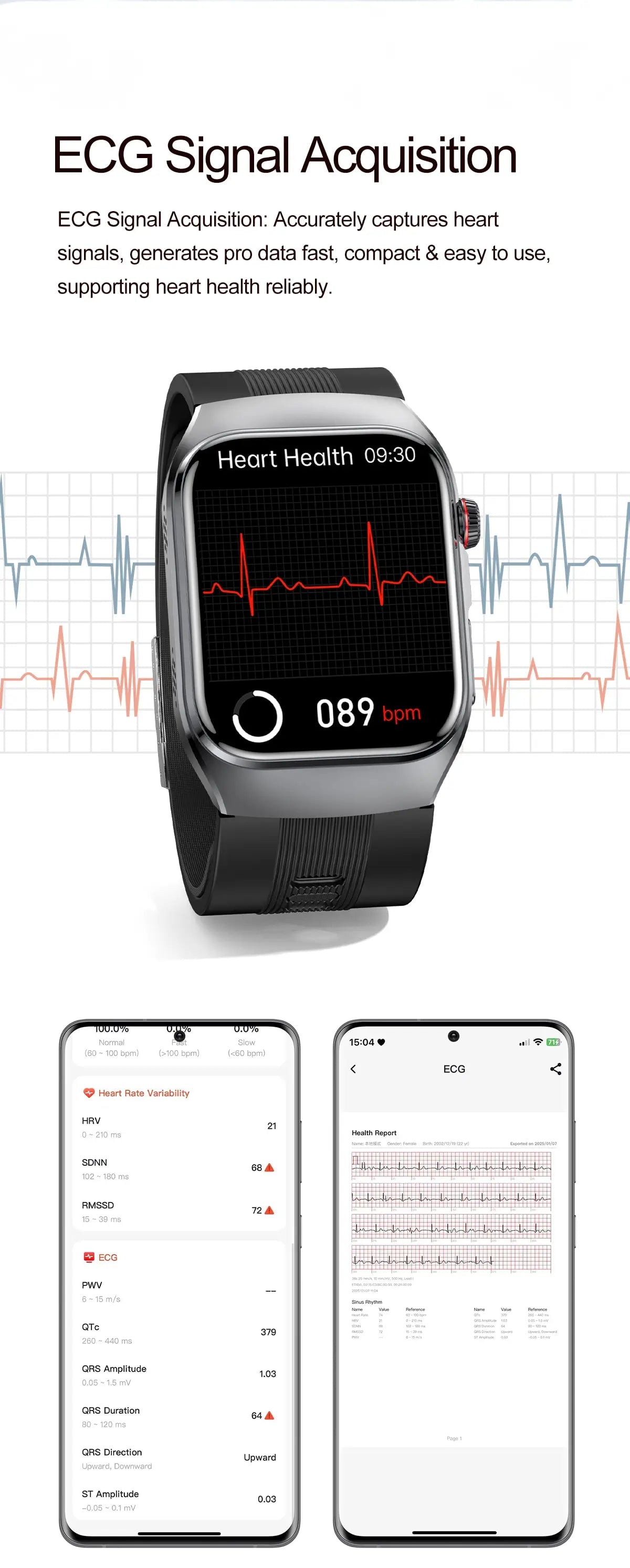 Blood Pressure Smartwatch with Continuous BP Monitoring, Heart Rate & ECG Fitness Tracker for Men Women