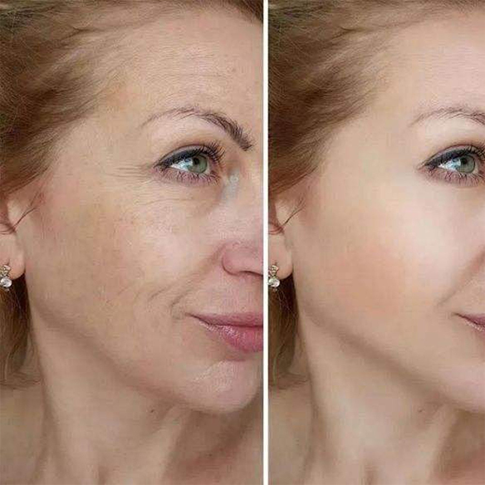 Barubt Calcium Power Multi Balm​ Eye Cream Stick