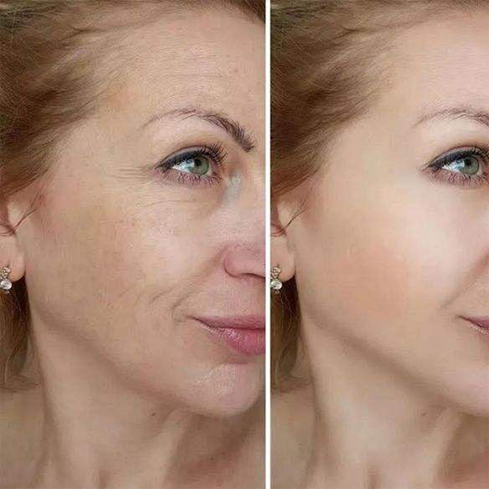 Barubt Calcium Power Multi Balm​ Eye Cream Stick