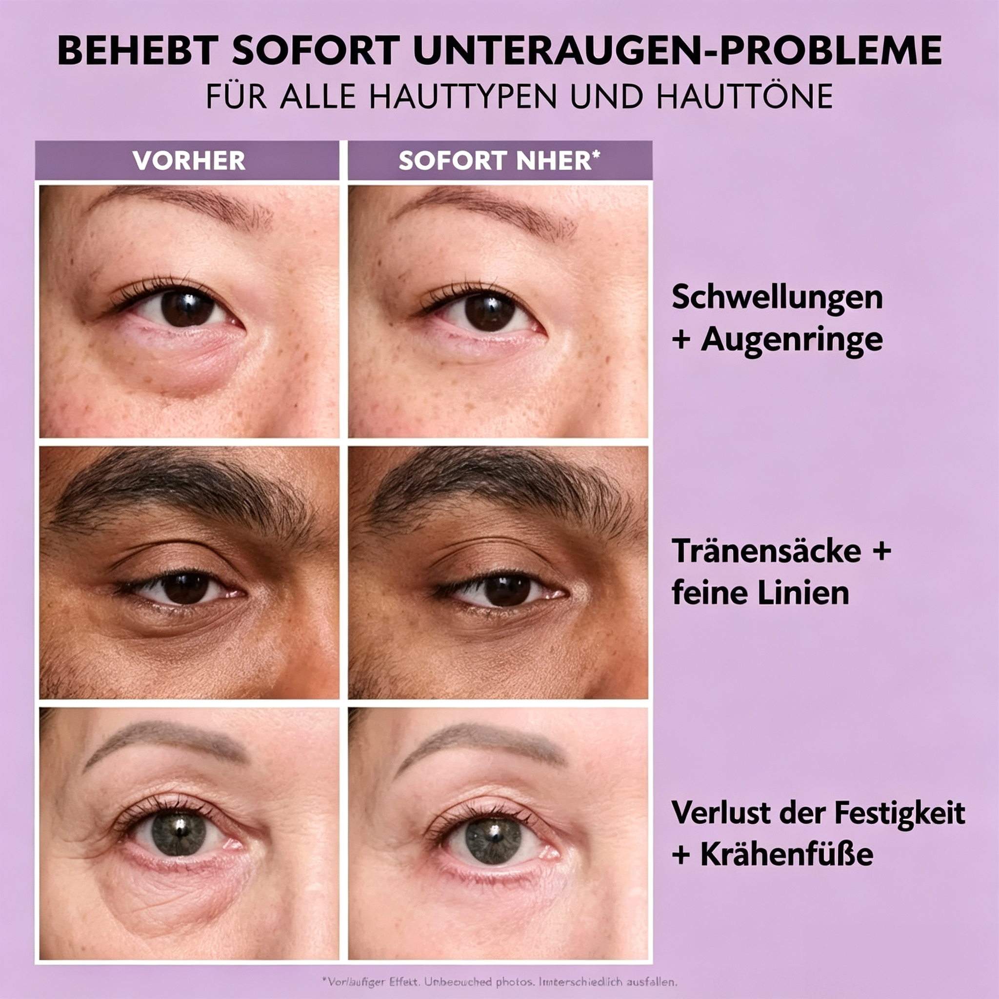 🔥Letzter Tag 50 % Rabatt – Instant FirmX Easy Wear Gesichtsstraffungscreme✨