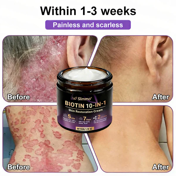 Made and Shipped from USA ✨QIAWI® Biotin 10-in-1 Skin Restoration Cream 🍀