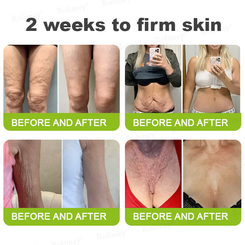 ✨👨‍⚕️♦️Made and shipped from the UK 💫Rolimey® Botox & Vita-A Retinol Shot Wrinkle-Lift Tightening cream - Last Day Promotion 70% OFF