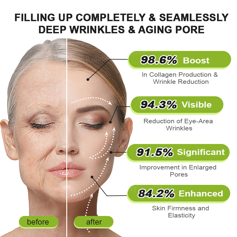 ✨👨‍⚕️♦️Made and shipped from the UK 💫Rolimey® Botox & Vita-A Retinol Shot Wrinkle-Lift Tightening cream - Last Day Promotion 70% OFF