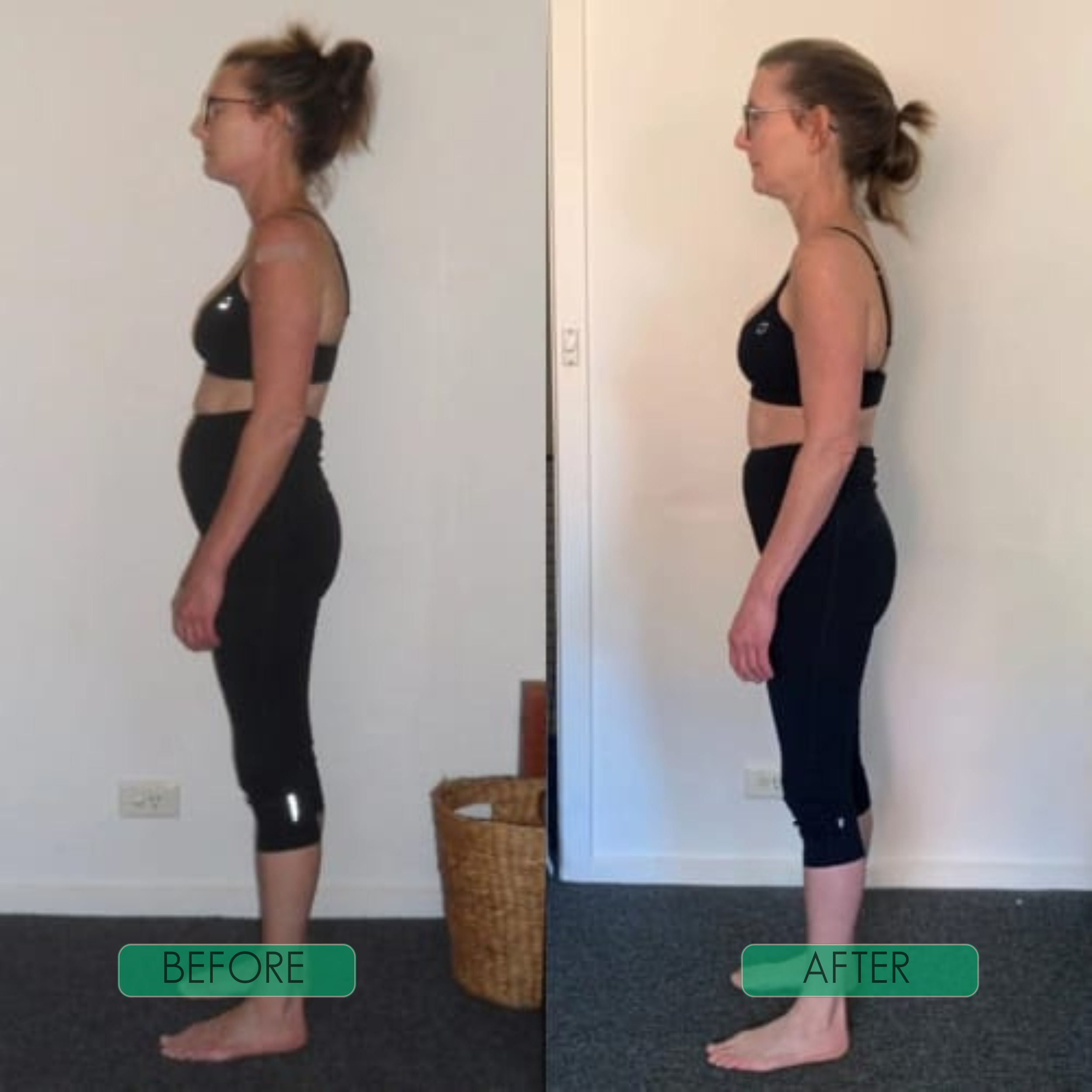 🔥nstant Posture Corrector Limited  Offer: Buy 1 Get 1 Free ✅Add 2 items to cart to activate offer