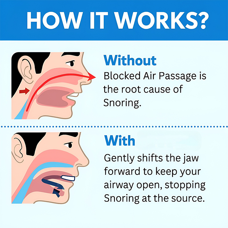Upgraded Design！ Universal Anti-Snoring Mouthpiece - Adjustable Comfort Fit for Better Sleep 😴