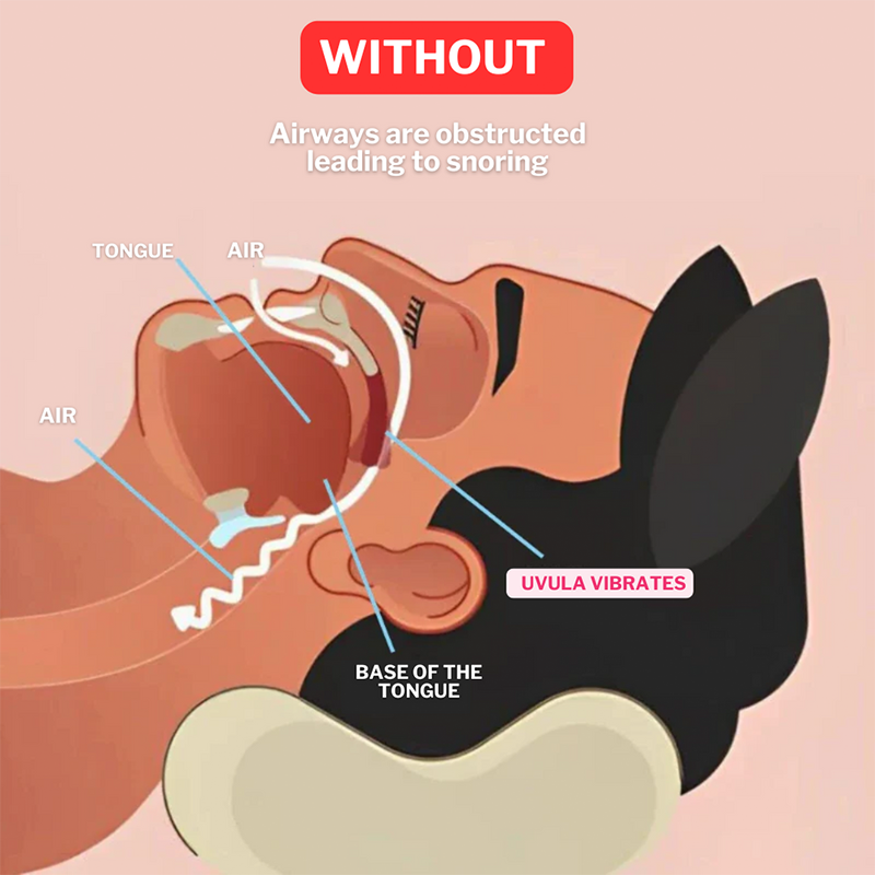 Upgraded Design！ Universal Anti-Snoring Mouthpiece - Adjustable Comfort Fit for Better Sleep 😴