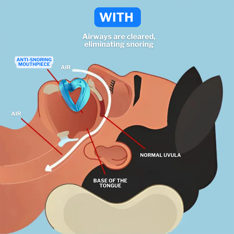 Upgraded Design！ Universal Anti-Snoring Mouthpiece - Adjustable Comfort Fit for Better Sleep 😴