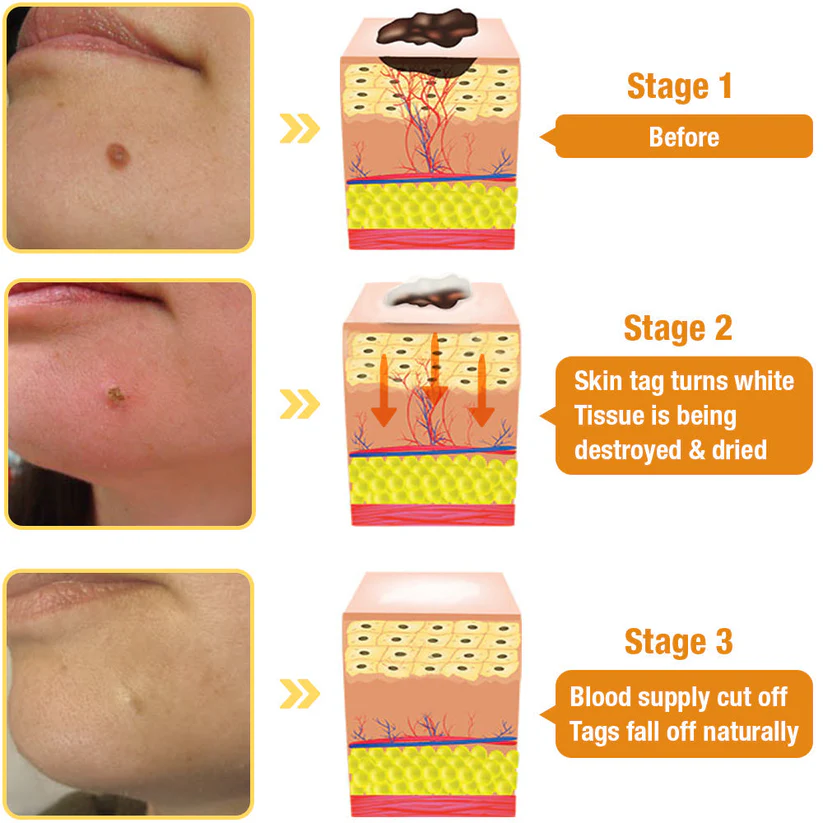 TagRecede Bee Venom Spray