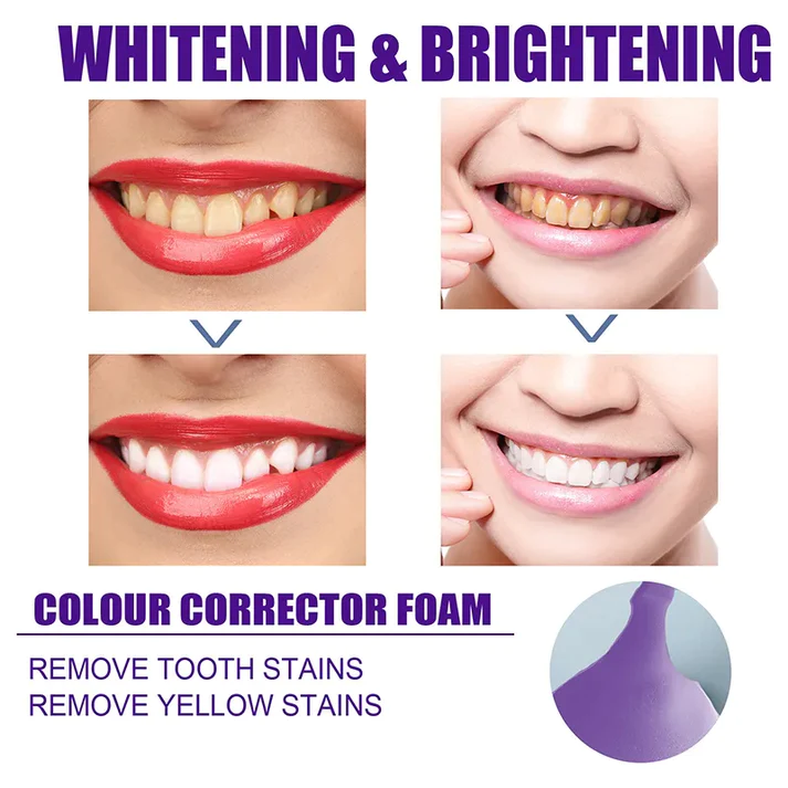  Mousse Cleaning Whitening Toothpaste