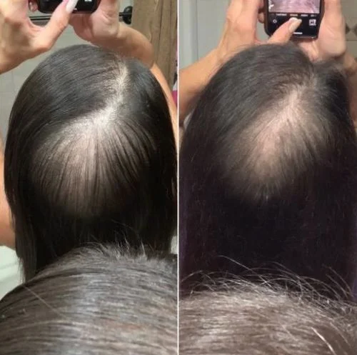 Natural Hair Growth Oil