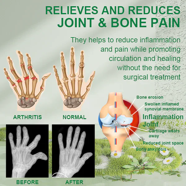 🐝New Zealand Bee Venom Joint and Bone Therapy Advanced Cream