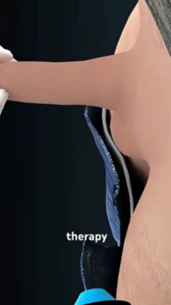 Advanced pulse technology