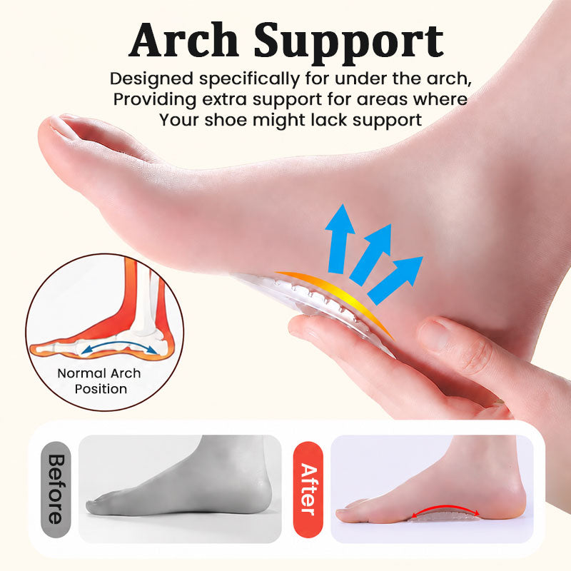 Clear Silicone Arch Support Pads | Gel Foot Arch Cushion Inserts