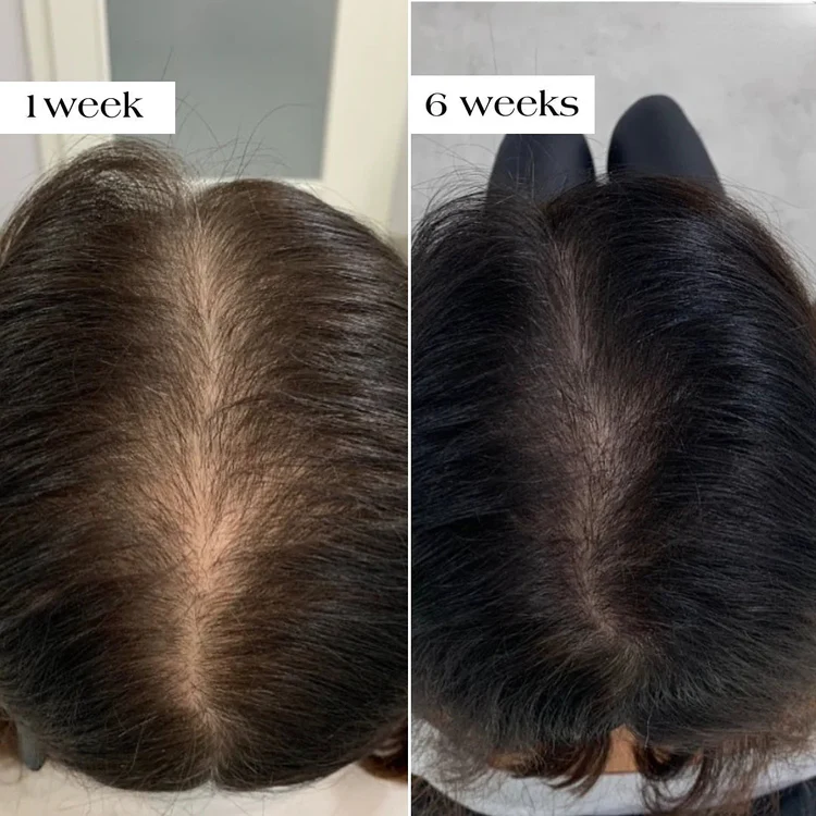 Scalp Treatment Progress