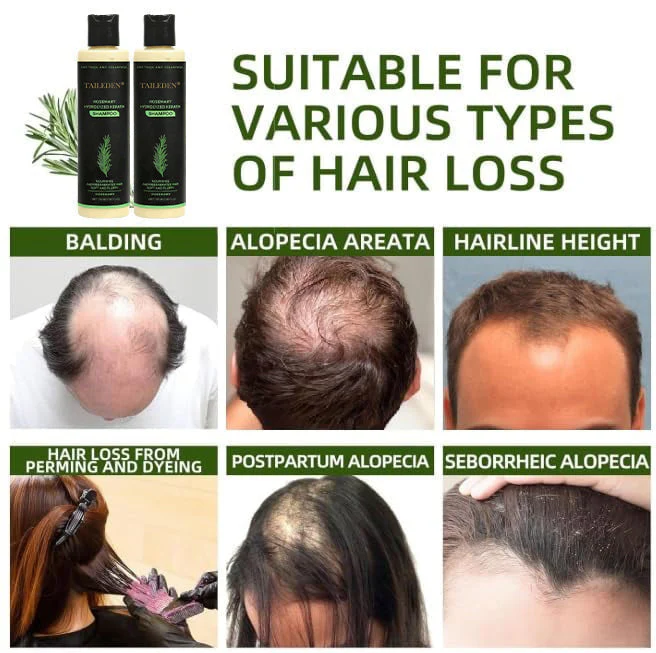 🔥2026 Hot Sale - 🎅Organic Rosemary Hair Growth Shampoo