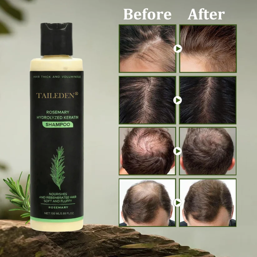 🔥2026 Hot Sale - 🎅Organic Rosemary Hair Growth Shampoo